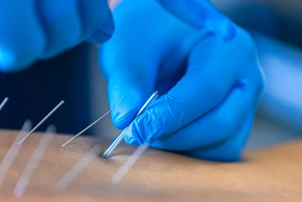 PTA Integration in Dry Needling